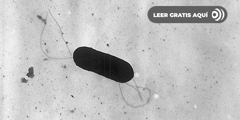 Alertan de la presencia de listeria en quesos distribuidos en en España