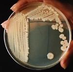 La bacteria Bacillus subtilis.