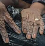 En la imagen, las manos de una damnificada por el KATRINA.