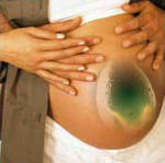 El embarazo como lucha de clases