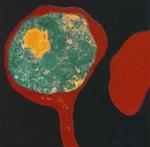 El Plasmodium faldiparum, la especie más letal del parásito de la malaria.