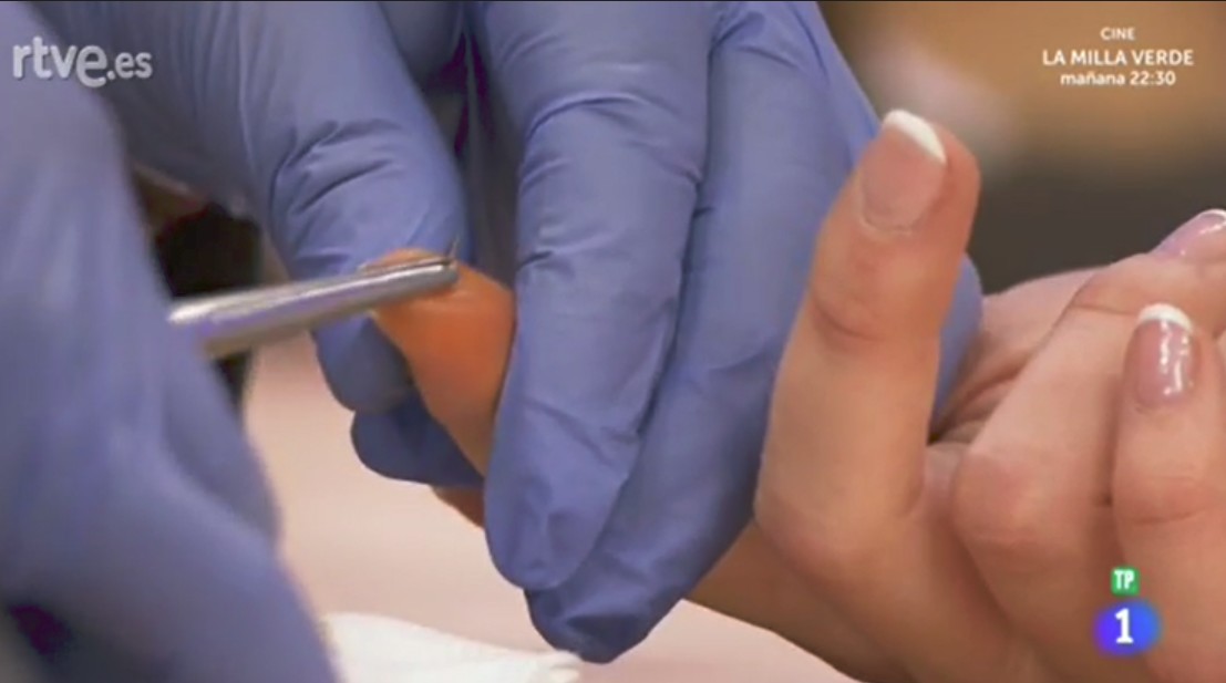 herida-alicia-aguja-maestros-de-la-costu