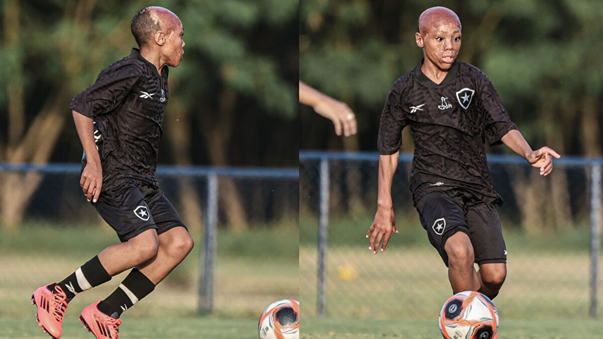 La historia de superación de Bernardo Lopes: de sufrir quemaduras de tercer grado a fichar por el Botafogo