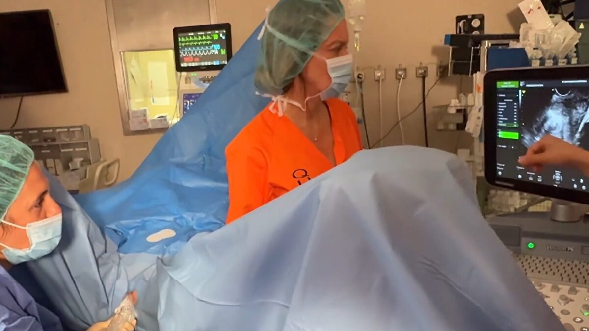 La sanidad madrileña, pionera en España en tratar con éxito miomas a mujeres con una técnica mínimamente invasiva