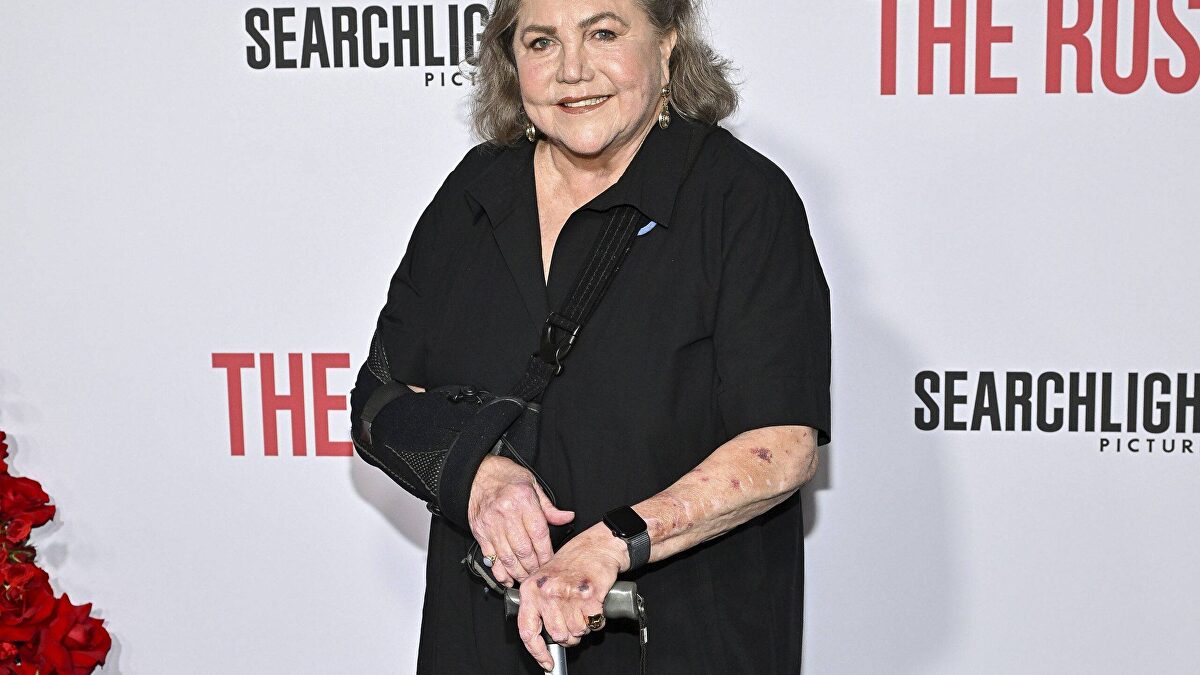 Kathleen Turner padece una enfermedad reumática que le ha causado obesidad