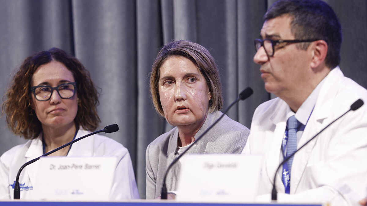 Hito en Barcelona: primer trasplante de cara del mundo procedente de una donante de eutanasia