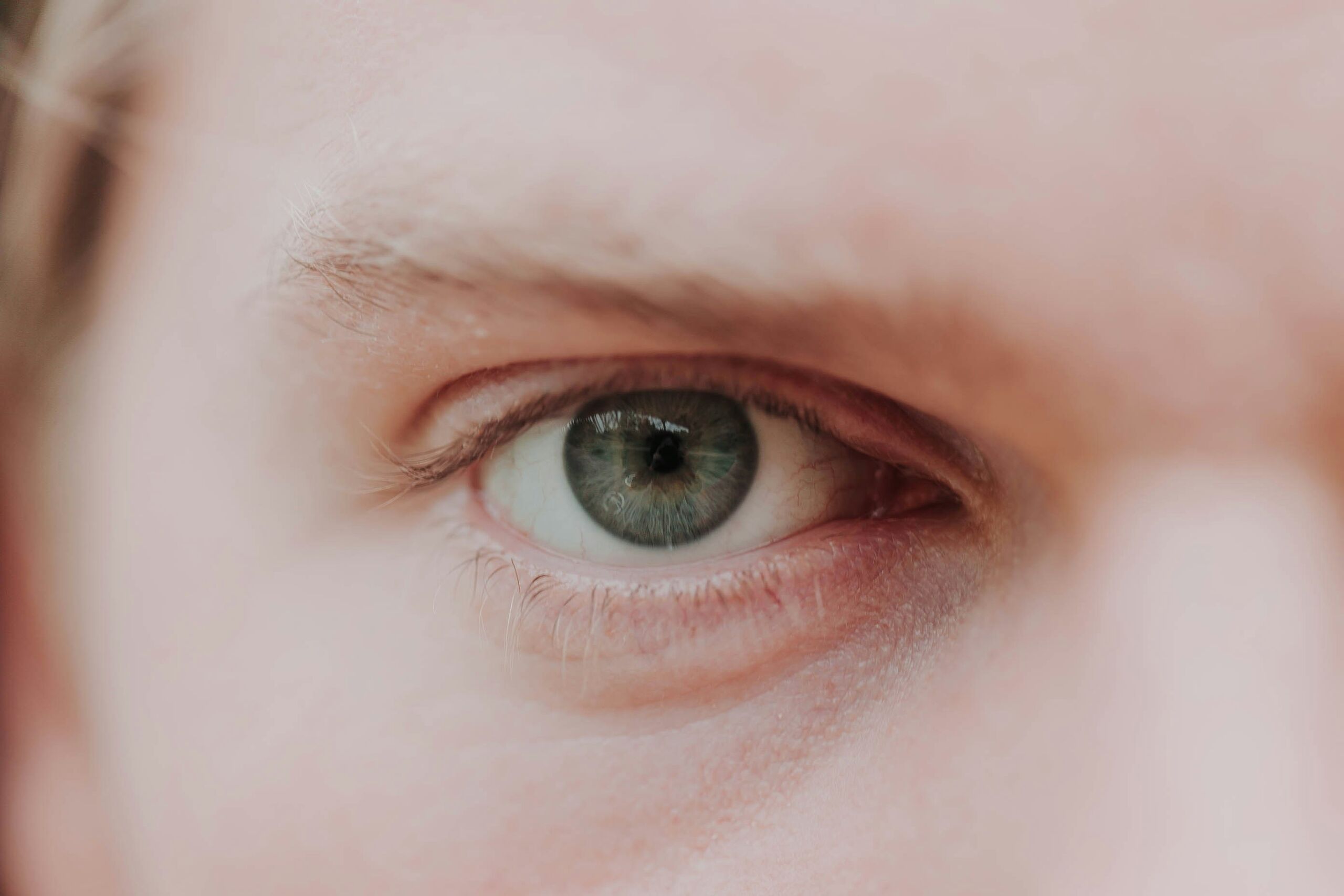 Por qué salen las ojeras: el aviso del cuerpo que va más allá del simple cansancio