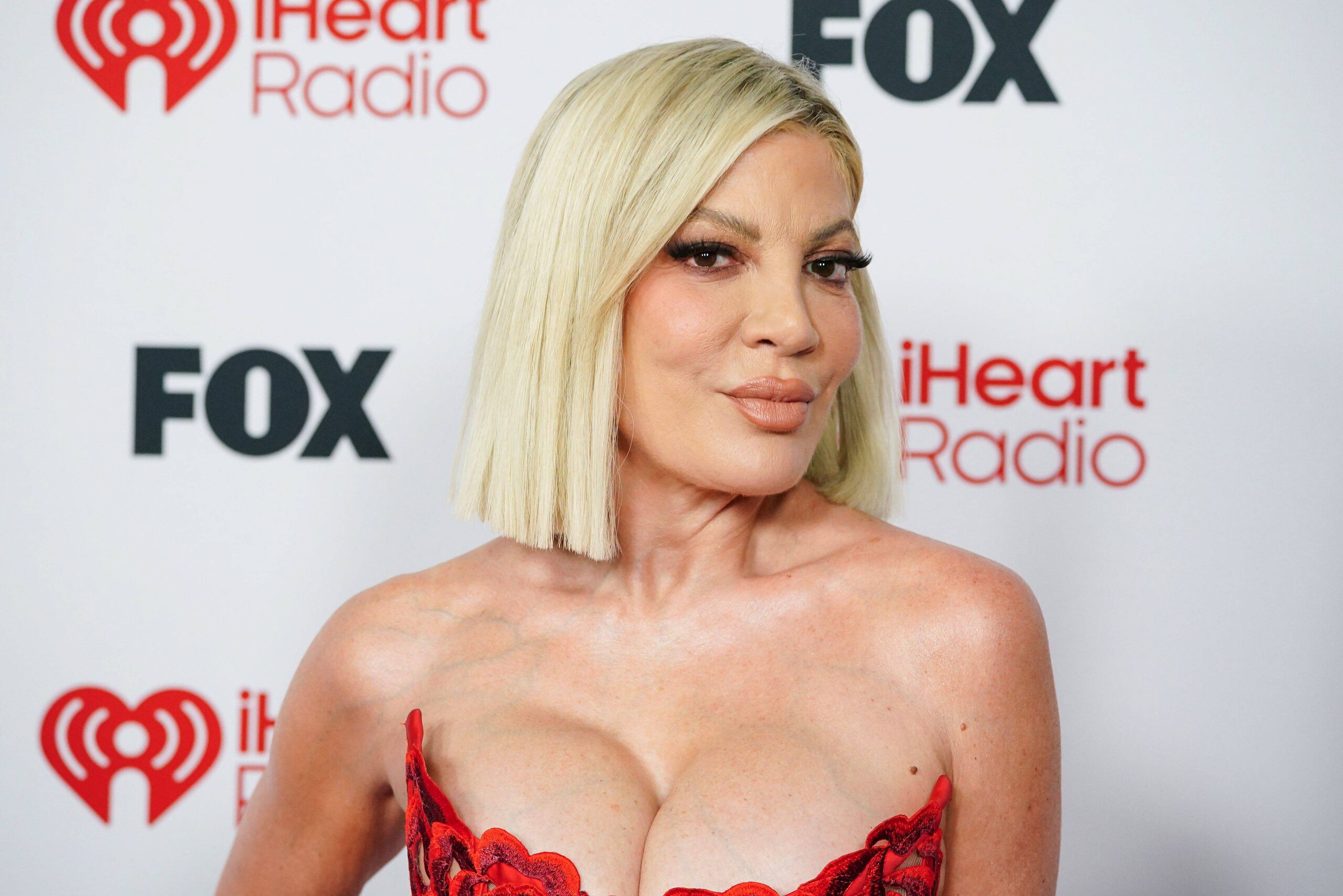 Tori Spelling hospitalizada tras sufrir un accidente de tráfico con siete menores